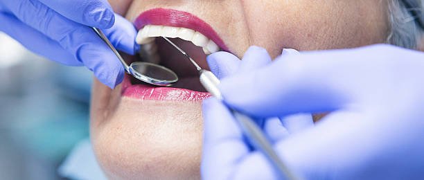 Best Emergency Wisdom Tooth Extraction in Enfield, NC
